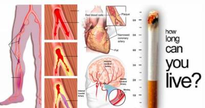 How Cigarette Smoking Affects Your Whole Body