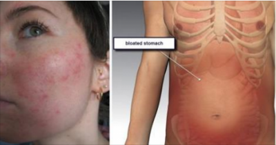 Critical Signs Of Poor Digestion You Should Never Ignore
