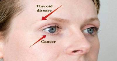 8 Things Your Eyes Can Tell You About Your Health