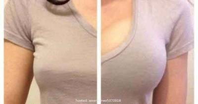 Learn How To Increase Your Cup Size Appearance Magically Without Surgery
