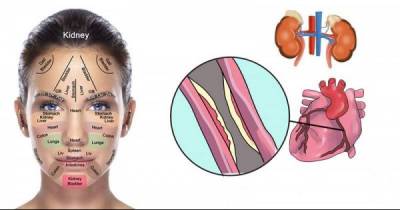 Your Face is Covered With Signs, Here&rsquo;s How To Tell What&rsquo;s Wrong With Your Kidneys, Hormones And Liver