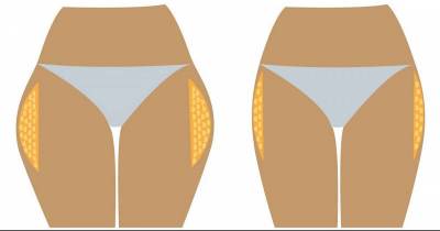 Burn Thigh Fat Fast With THESE 3 Simple Steps!