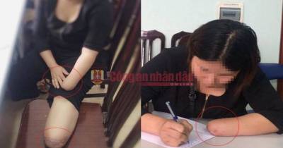Woman Hires Someone To Cut Her Limbs Off In Order To Claim Health Insurance!