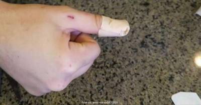 You've Been Applying Band-Aids Wrong Your Whole Life. Watch How It's Really Done