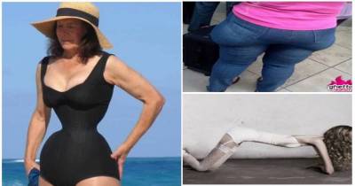 These 10 People With Weird Body Shapes Will Leave You Shocked