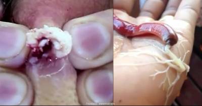 The Weird Things That Come Out Of Your Body