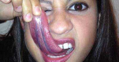 This Woman&rsquo;s Tongue Is So Long She Can Lick Her Own Eyeball