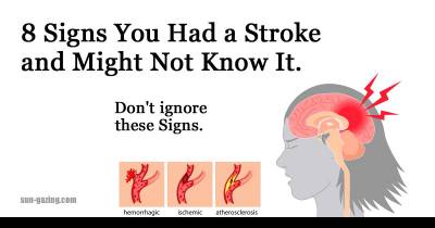 8 Signs You Had A Stroke And Might Not Know It.