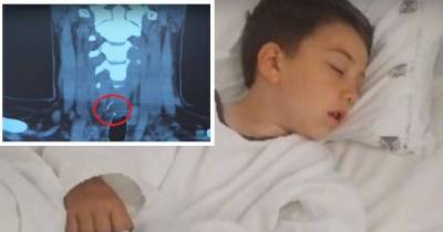 Kid Feels Stabbing Pain While Eating Hamburger. Hours Later, X-Ray Reveals The Culprit.