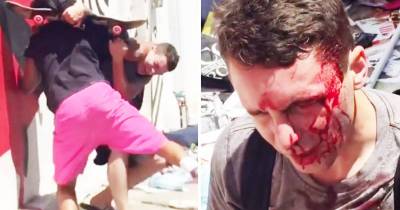 Bully Left Bloody After Picking Fight Over $10