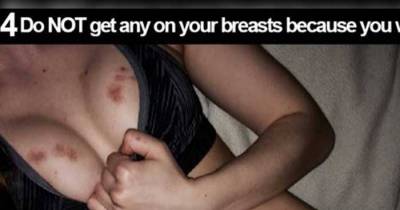 Facts About Hickeys That Will Blow Your Mind
