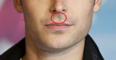 Here&rsquo;s What It Means If You Have A Cavity Between Your Nose And Upper Lip