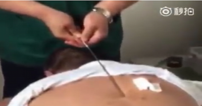 This Is The Most Insane 'Medical' Treatment I've Ever Seen