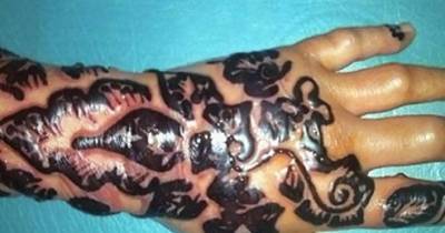 9 Horrible and Unexpected Tattoo After Effects That Will Make Think Twice About Getting Your Buddy To Give You Ink.