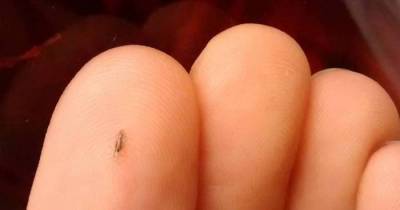 13 Facts About Head Lice That&rsquo;ll Make You Want To Shave Your Head