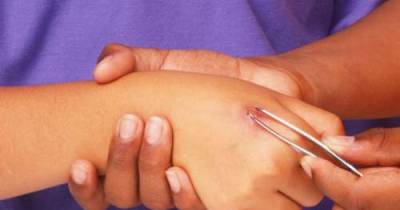 Be Careful And Do Not Make These 5 First Aid Mistakes