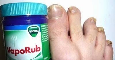 Twelve Surprising Things You Can Do With VapoRub (Even If You Don&rsquo;t Have A Cold)