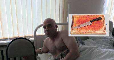 Russian Man Performed Circumcision On Himself Using Knife And Chopping Board After Doctors Refused To Help Him