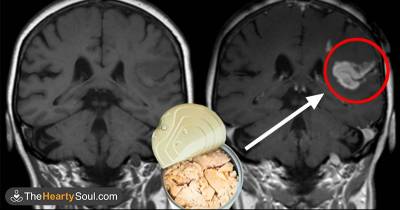10 Foods You Need To Eat Right Now To Remove Toxic Mercury From Your Body