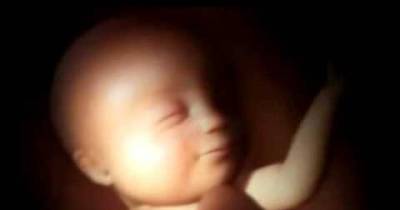 6 GIFs Of Babies Dancing Inside Their Mommies That Are Creepy AF