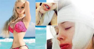 12 Pictures Of 6 People Who'll Do Anything To Become Real Life Barbie