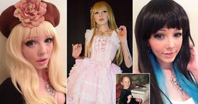 Rare Genetic Condition That Turned This Woman Into A Real-Life &lsquo;Human Barbie&rsquo;
