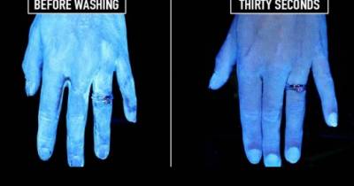 This Hand Washing Experiment Will Shock You And Open Your Eyes Towards Personal Hygiene