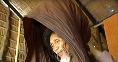 When His Wife Removed The Scarf From His Head, Everyone Was Speechless. No One Would Have Expected All That Hair.