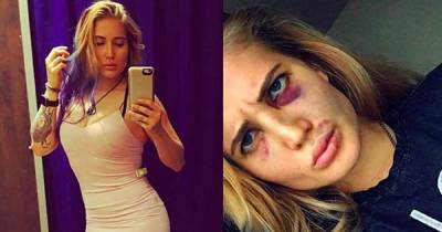 This Female MMA Fighter&rsquo;s Instagram Shows The Beauty And Harsh Realities Of Fighting!