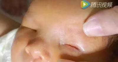 Mother Is Devastated After Her Child Is Born With No Eyes