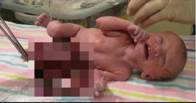 The Doctor Looked At The Ultrasound And Advised The Woman To Terminate, But She Refused