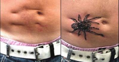 People Use Tattoos To Cover Up Embarrassing Scars And Regain Their Confidence