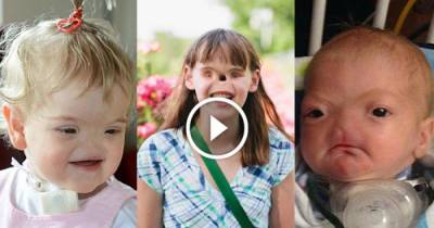 These 3 Kids Who Were Born Without Noses Defied The Odds And Inspired The Whole World