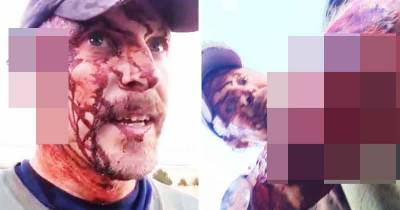 Montana Man Films Brutal Aftermath Of Grizzly Bear Attack