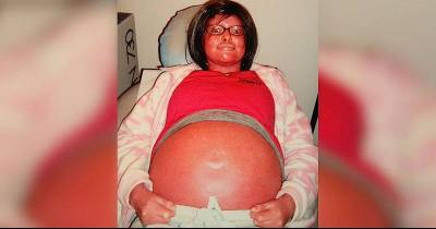 Woman With Rare Condition Gets Pregnant, Then Doctors Say They&rsquo;ve Never Seen A Baby Like Hers