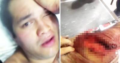 Dude Films Brutal Aftermath Of Tiger Shark Attack