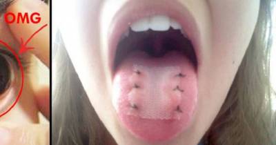 Insane Plastic Surgeries You Have To See To Believe
