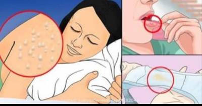 These Health Signs Indicate That You Might Have HIV/AIDS