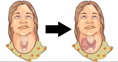 5 Bad Habits That Make Thyroid Problems Worse
