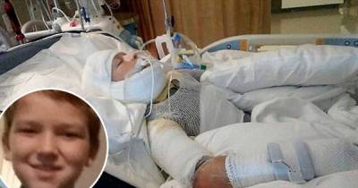 10-year-old &lsquo;Special Needs&rsquo; Boy &lsquo;Deliberately Set On Fire By Bullies&rsquo; Is Fighting For Life In Hospital