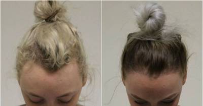If You Wear Your Hair In A Bun Every Day You Should Stop Now.