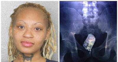 Woman Shoves ID Card Inside Herself When Police Pull Car Over, Undergoes Surgery To Get It Removed