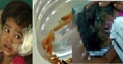 Girl Has 80 Worms Removed From Her Ear After Insect Attracted To Dirty Conditions Entered Her Body