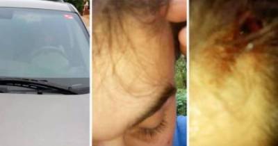 Guy Gets Beat With Metal Pipe And Run Over By Abusive Ex-Girlfriend