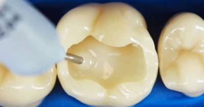 How A Dentist Fixes A Decayed Tooth