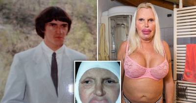 This Is What Happens When Plastic Surgery Goes Wrong