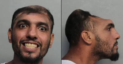 Half Skull Man Facing Prison For Attempted Arson