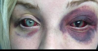 Dad Finds Out About Daughter&rsquo;s Abusive BF, Takes Matters Into Own Hands