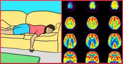 The 12 Early Warning Signs Of Dementia Every Woman Should Know