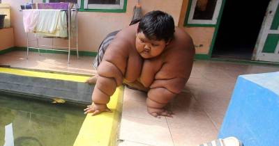 This 10-Year-Old Is The Fattest Kid In The World And Weighs 423lbs.